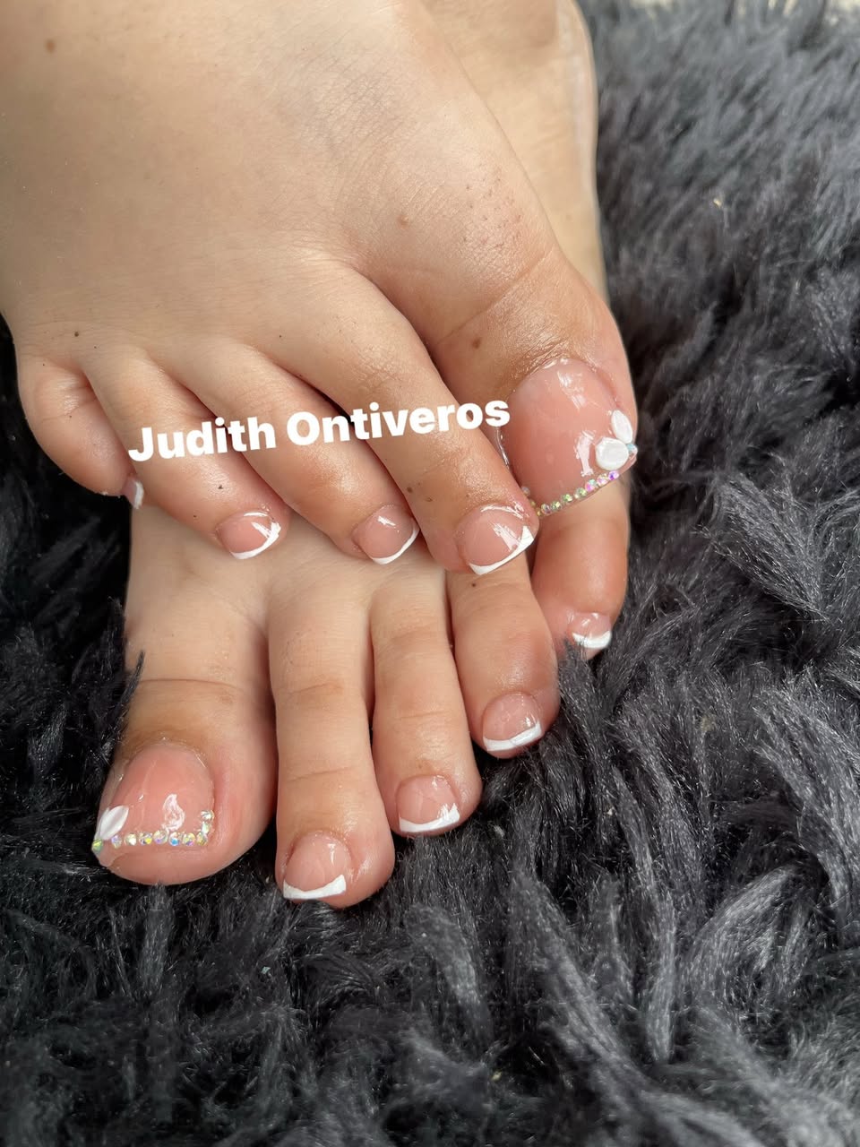 Acripie Uñas Sanas