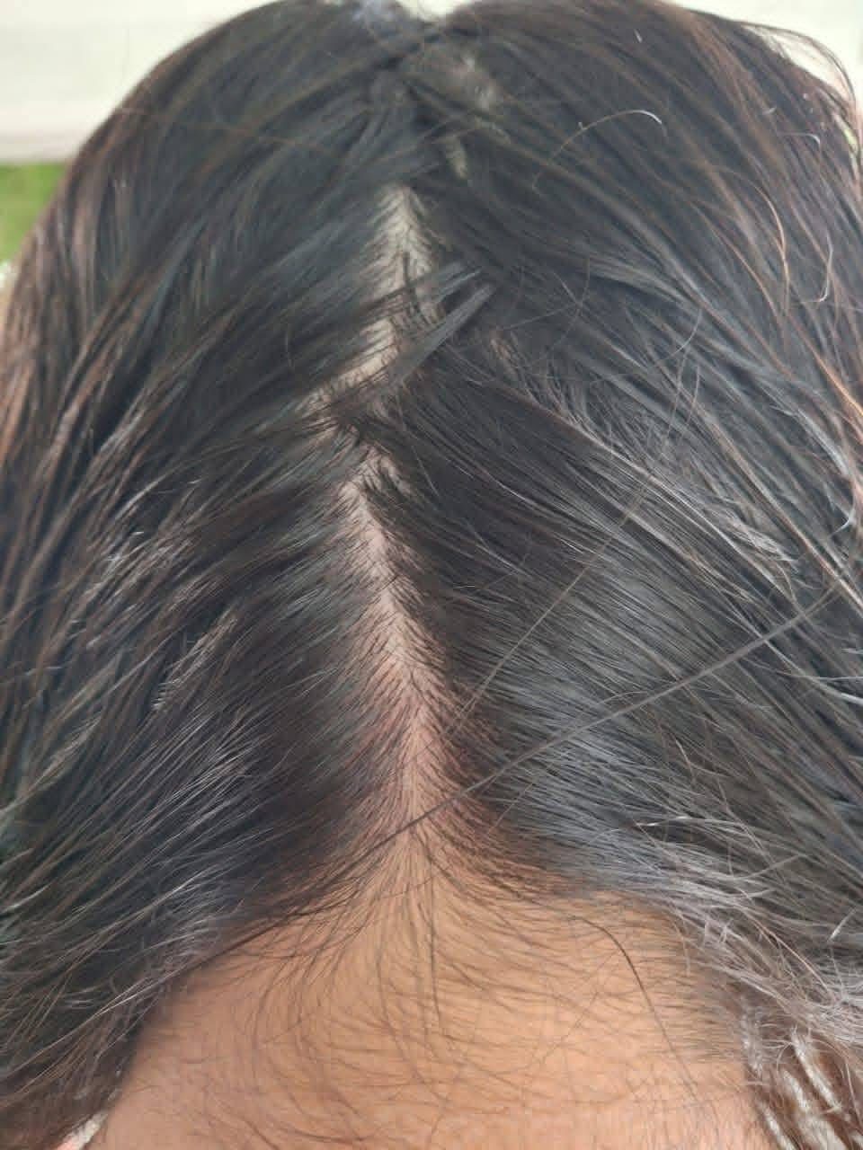 Clínica sin piojos