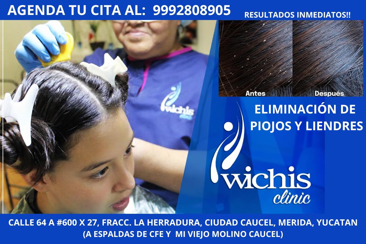 Eliminación de Piojos y Liendres Naturales en 90 Minutos