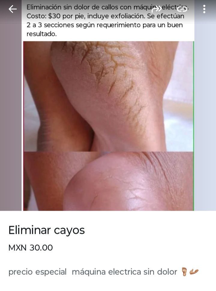 Estética de Uñas y Belleza Geovanny Millán — Vergel