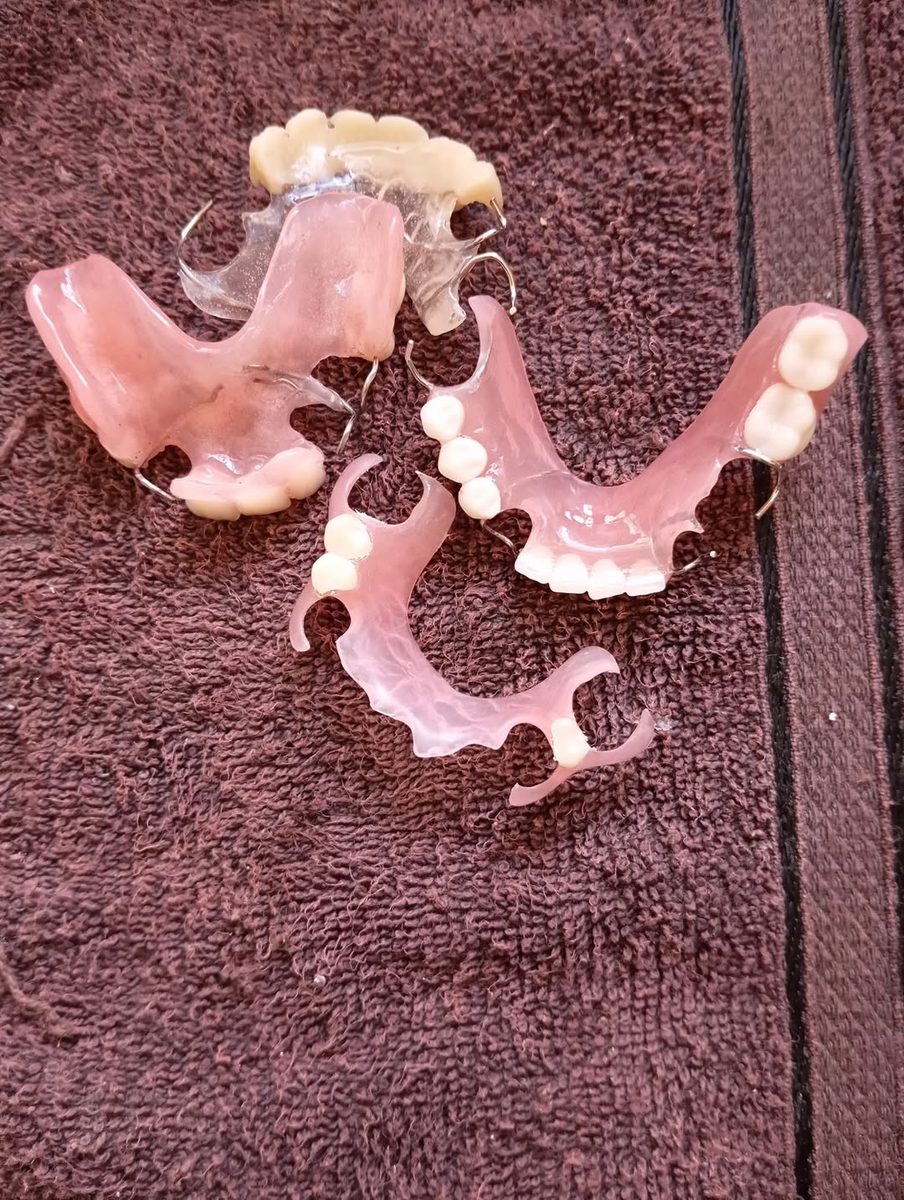 Reparación de Dentaduras — Las Américas