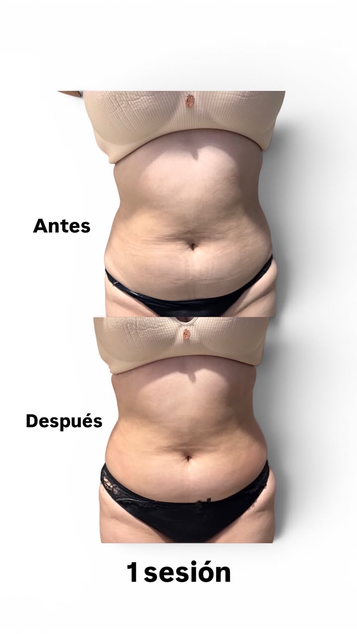 Promociones de Spa para Junio