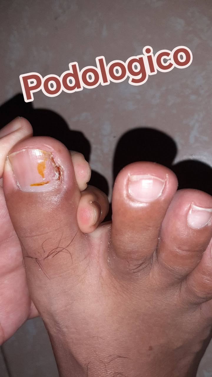 Servicios completos de Pedicura Estética y Clínica para el Cuidado Integral de sus Pies