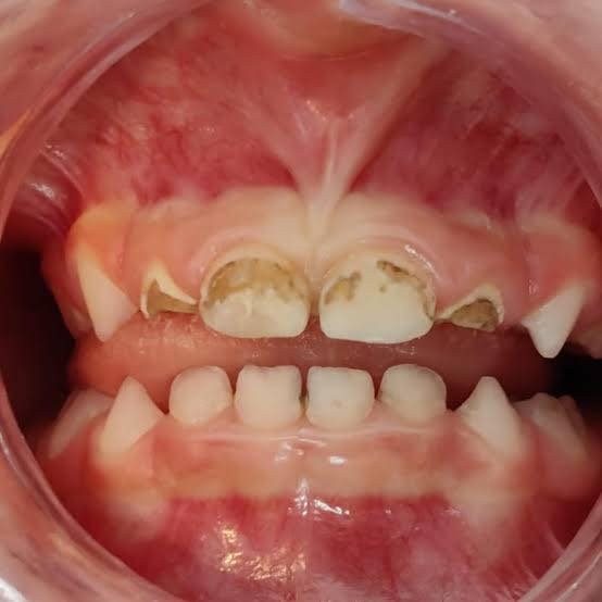 Servicios Odontológicos Infantiles - Maite Kancab