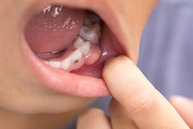 Servicios Odontológicos Infantiles - Maite Kancab