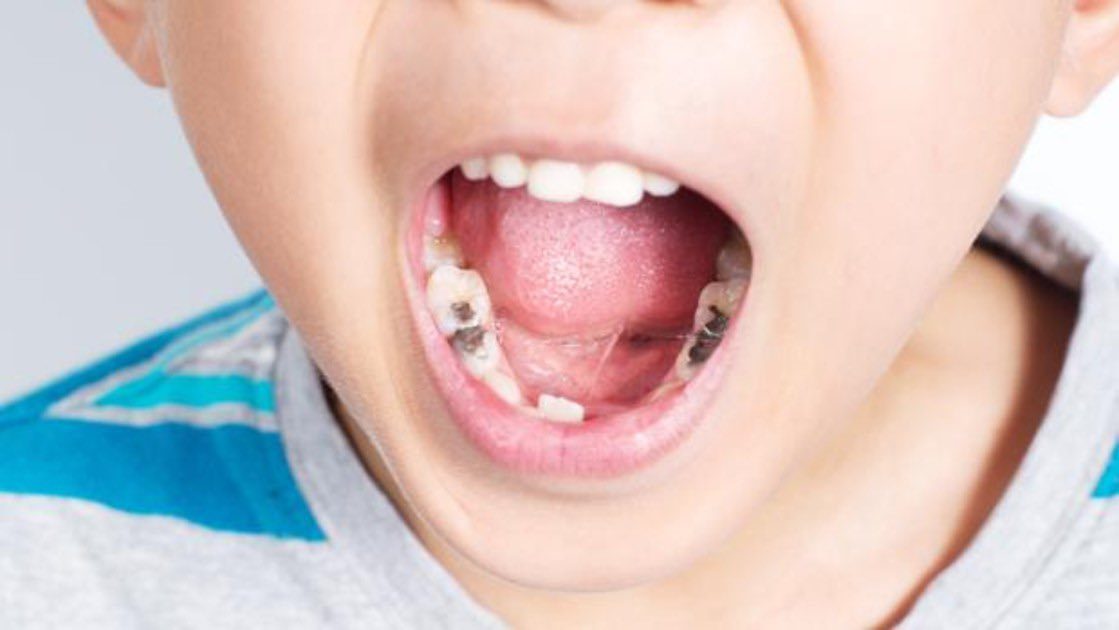 Servicios Odontológicos Infantiles - Maite Kancab