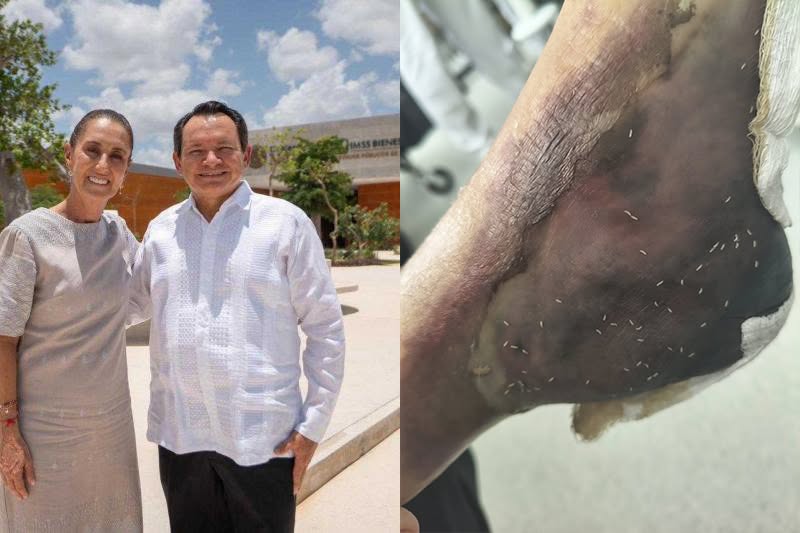 Paciente del Hospital O'Horán denuncia negligencia y abandono