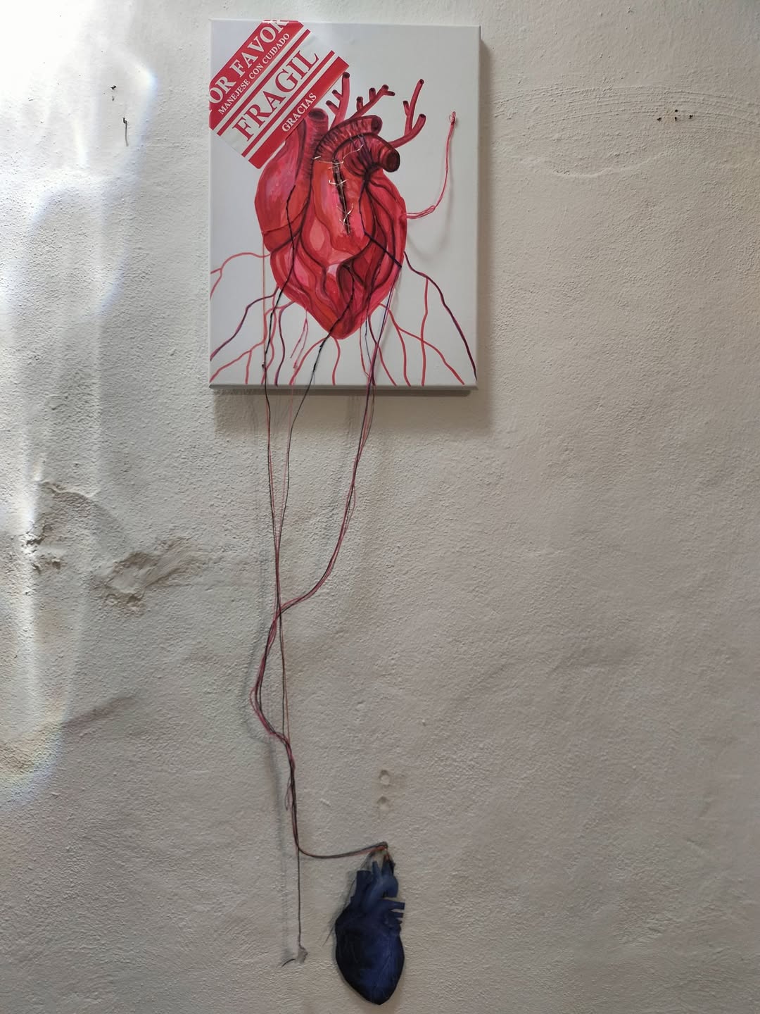 Artista transforma su lucha contra la vasculitis en una obra de arte